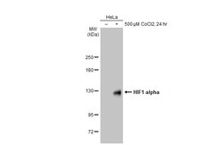 Invitrogen HIF1A Polyclonal Antibody 100 &mu;L | Buy Online | Invitrogen&trade; | Fisher Scientific