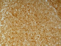 Invitrogen N-cadherin Polyclonal Antibody 100 &mu;L; Unconjugated:Antibodies,