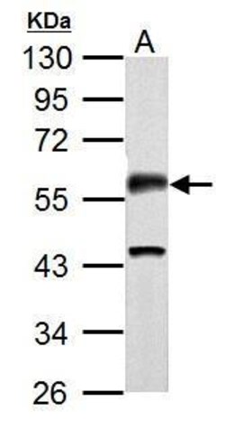 Invitrogen Phospho-CaMKII alpha (Thr286) Polyclonal Antibody 100 &mu;L;