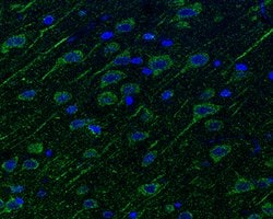 Invitrogen Neuropilin 1 Polyclonal Antibody 100 &mu;L; Unconjugated:Antibodies,