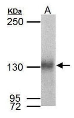 Invitrogen Neuropilin 1 Polyclonal Antibody 100 &mu;L; Unconjugated:Antibodies,