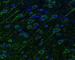 Invitrogen Neuropilin 1 Polyclonal Antibody 100 &mu;L; Unconjugated:Antibodies,
