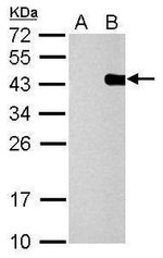 PITX2 Polyclonal Antibody, Invitrogen™