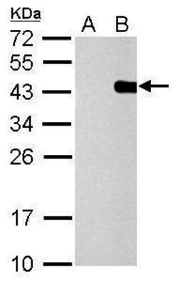 PITX2 Polyclonal Antibody:Antibodies, Polyclonal