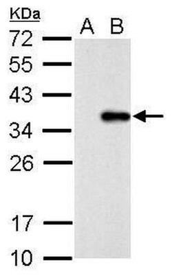 Invitrogen COL11A2 Polyclonal Antibody 100 &mu;L; Unconjugated:Antibodies,