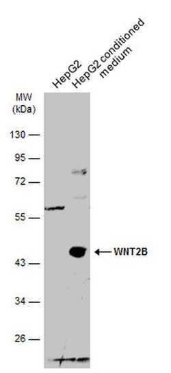 Invitrogen WNT2B Polyclonal Antibody 100 &mu;L; Unconjugated:Antibodies,