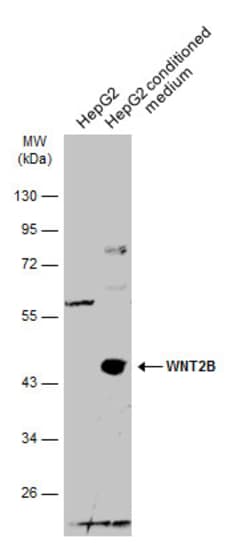 Invitrogen WNT2B Polyclonal Antibody 100 &mu;L; Unconjugated:Antibodies,