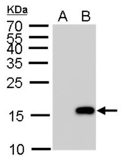 Invitrogen Phospho-Histone H3 (Ser10) Polyclonal Antibody 100 &mu;L; Unconjugated:Antibodies,