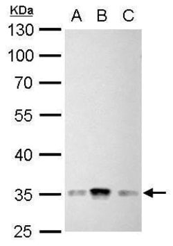 Invitrogen Phospho-CDK1 (Tyr15) Polyclonal Antibody 100 &mu;L; Unconjugated:Antibodies,