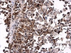 Invitrogen Phospho-CDK1 (Tyr15) Polyclonal Antibody 100 &mu;L; Unconjugated:Antibodies,