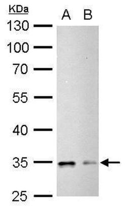 Invitrogen Phospho-CDK1 (Tyr15) Polyclonal Antibody 100 &mu;L; Unconjugated:Antibodies,