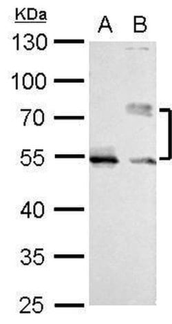 Cdc25C Rabbit anti-Human, Mouse, Rat, Polyclonal, Invitrogen 100 &mu;L;