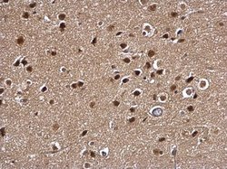 Invitrogen MYT1 Polyclonal Antibody 100 &mu;L | Buy Online | Invitrogen&trade; | Fisher Scientific