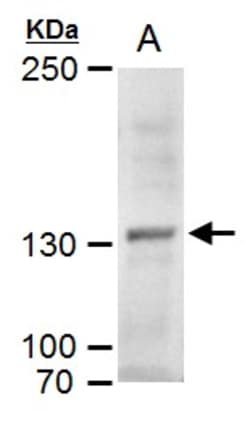 Invitrogen MYT1 Polyclonal Antibody 100 &mu;L | Buy Online | Invitrogen&trade; | Fisher Scientific
