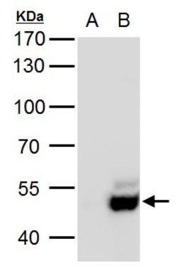 Invitrogen USP3 Polyclonal Antibody 100 &mu;L; Unconjugated:Antibodies,