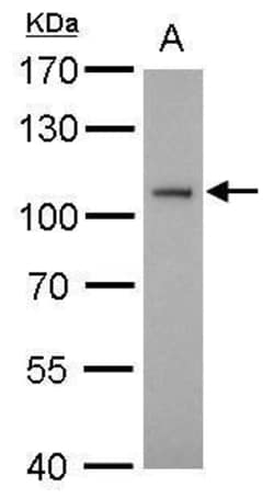 Invitrogen ATG9A Polyclonal Antibody 100 &mu;L; Unconjugated:Antibodies,