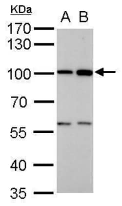 Invitrogen ATG9A Polyclonal Antibody 100 &mu;L; Unconjugated:Antibodies,