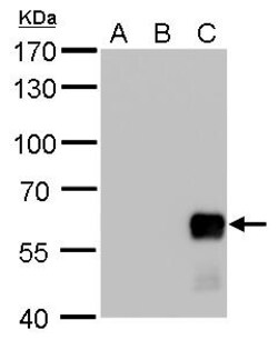 Invitrogen AKT2 Polyclonal Antibody 100 &mu;L | Buy Online | Invitrogen&trade; | Fisher Scientific