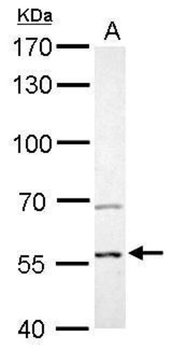 Invitrogen AKT2 Polyclonal Antibody 100 &mu;L | Buy Online | Invitrogen&trade; | Fisher Scientific