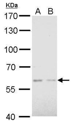 Invitrogen AKT2 Polyclonal Antibody 100 &mu;L | Buy Online | Invitrogen&trade; | Fisher Scientific