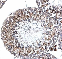 Invitrogen SLUG Polyclonal Antibody 100 &mu;L; Unconjugated:Antibodies,