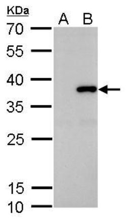 Invitrogen SLUG Polyclonal Antibody 100 &mu;L; Unconjugated:Antibodies,