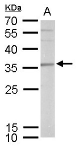 Invitrogen SLUG Polyclonal Antibody 100 &mu;L; Unconjugated:Antibodies,