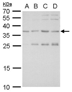 Invitrogen SLUG Polyclonal Antibody 100 &mu;L; Unconjugated:Antibodies,