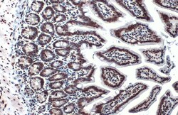 Invitrogen H3K18ac Polyclonal Antibody, ChIP-Verified 100 &mu;L; Unconjugated:Antibodies,
