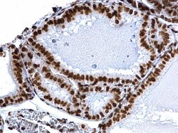 Invitrogen H3K18ac Polyclonal Antibody, ChIP-Verified 100 &mu;L; Unconjugated:Antibodies,