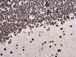 Invitrogen H3K27ac Polyclonal Antibody 100 &mu;L; Unconjugated:Antibodies,