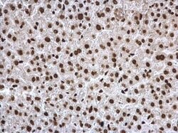 Invitrogen H3K27ac Polyclonal Antibody 100 &mu;L; Unconjugated:Antibodies,