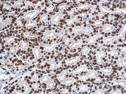 Invitrogen H3K27ac Polyclonal Antibody 100 &mu;L; Unconjugated:Antibodies,