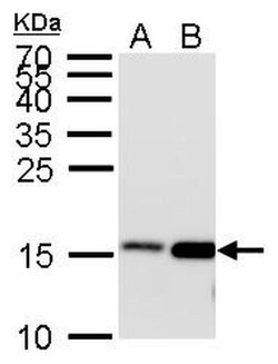 Invitrogen H3K27ac Polyclonal Antibody 100 &mu;L; Unconjugated:Antibodies,