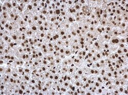 Invitrogen H3K27ac Polyclonal Antibody 100 &mu;L; Unconjugated:Antibodies,