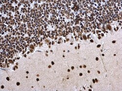 Invitrogen H3K27ac Polyclonal Antibody 100 &mu;L; Unconjugated:Antibodies,