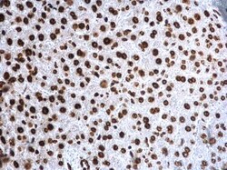 Invitrogen H4K20me3 Polyclonal Antibody 100 &mu;L; Unconjugated:Antibodies,