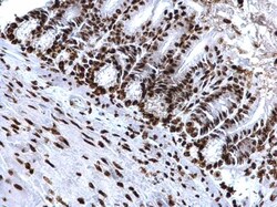 Invitrogen H4K20me3 Polyclonal Antibody 100 &mu;L; Unconjugated:Antibodies,