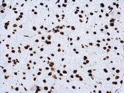 Invitrogen H4K20me3 Polyclonal Antibody 100 &mu;L; Unconjugated:Antibodies,