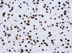 Invitrogen H4K20me3 Polyclonal Antibody 100 &mu;L; Unconjugated:Antibodies,