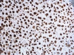Invitrogen H4K20me3 Polyclonal Antibody 100 &mu;L; Unconjugated:Antibodies,