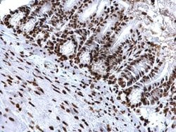 Invitrogen H4K20me3 Polyclonal Antibody 100 &mu;L; Unconjugated:Antibodies,