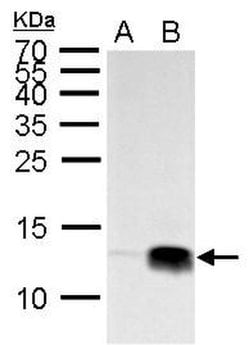 Invitrogen H4K20me3 Polyclonal Antibody 100 &mu;L; Unconjugated:Antibodies,