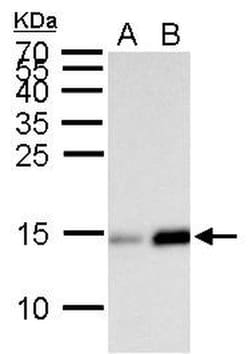 Invitrogen H2BK20ac Polyclonal Antibody 100 &mu;L; Unconjugated:Antibodies,