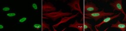 Invitrogen H2BK20ac Polyclonal Antibody 100 &mu;L; Unconjugated:Antibodies,