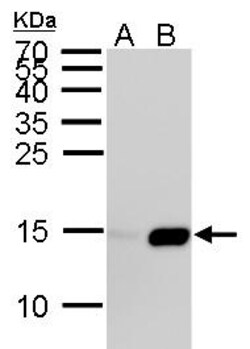 Invitrogen H2AK5ac Polyclonal Antibody 100 &mu;L; Unconjugated:Antibodies,