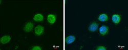 NAMPT Polyclonal Antibody, Invitrogen 100 &mu;L; Unconjugated:Antibodies,