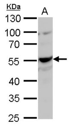 NAMPT Polyclonal Antibody, Invitrogen 100 &mu;L; Unconjugated:Antibodies,