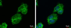 Invitrogen IGFBP2 Polyclonal Antibody 100 &mu;L; Unconjugated:Antibodies,
