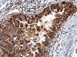 Invitrogen IGFBP2 Polyclonal Antibody 100 &mu;L; Unconjugated:Antibodies,